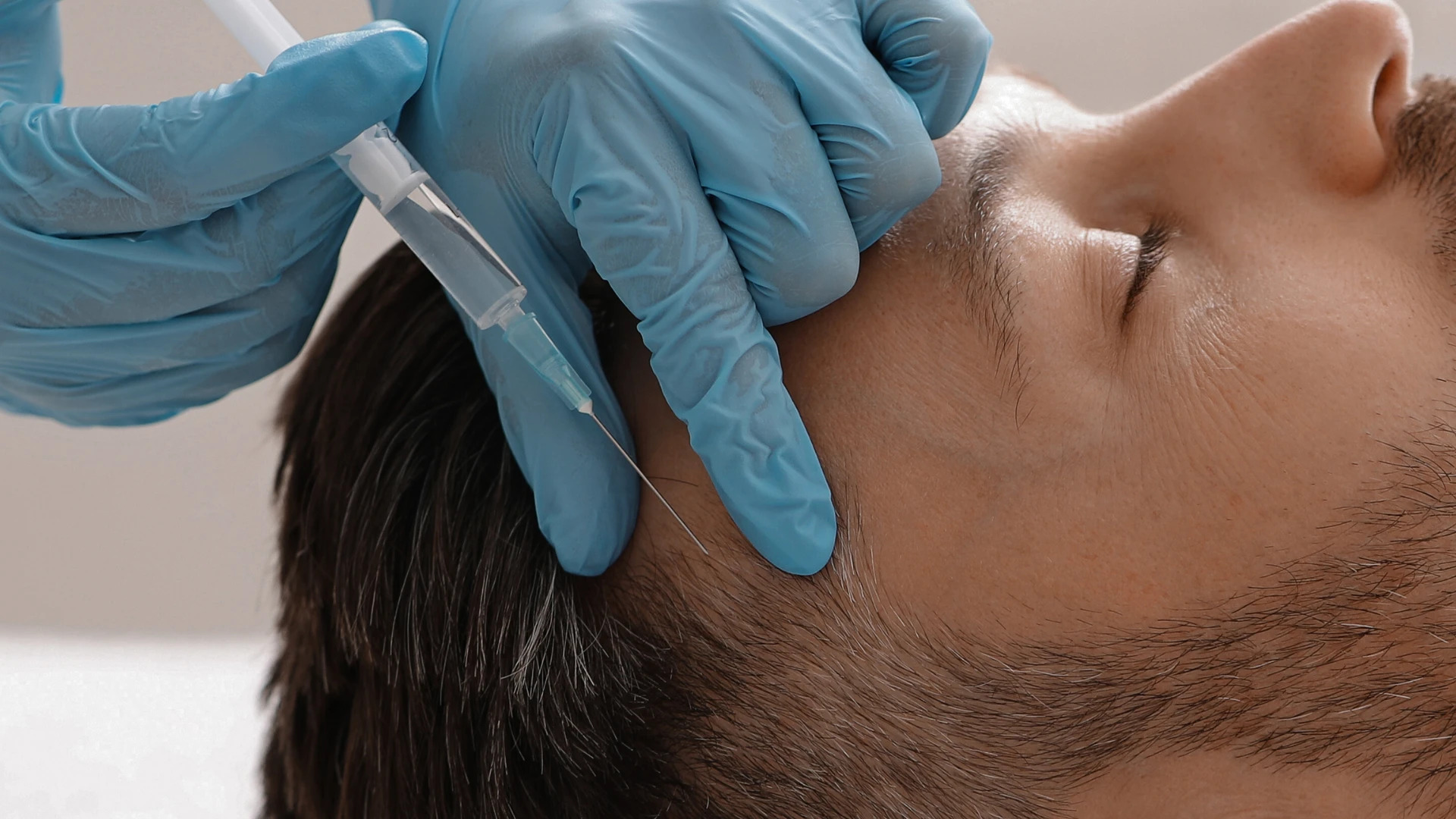 PRP treatment